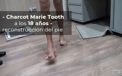 Charcot Marie Tooth a los 18 años: reconstrucción del pie